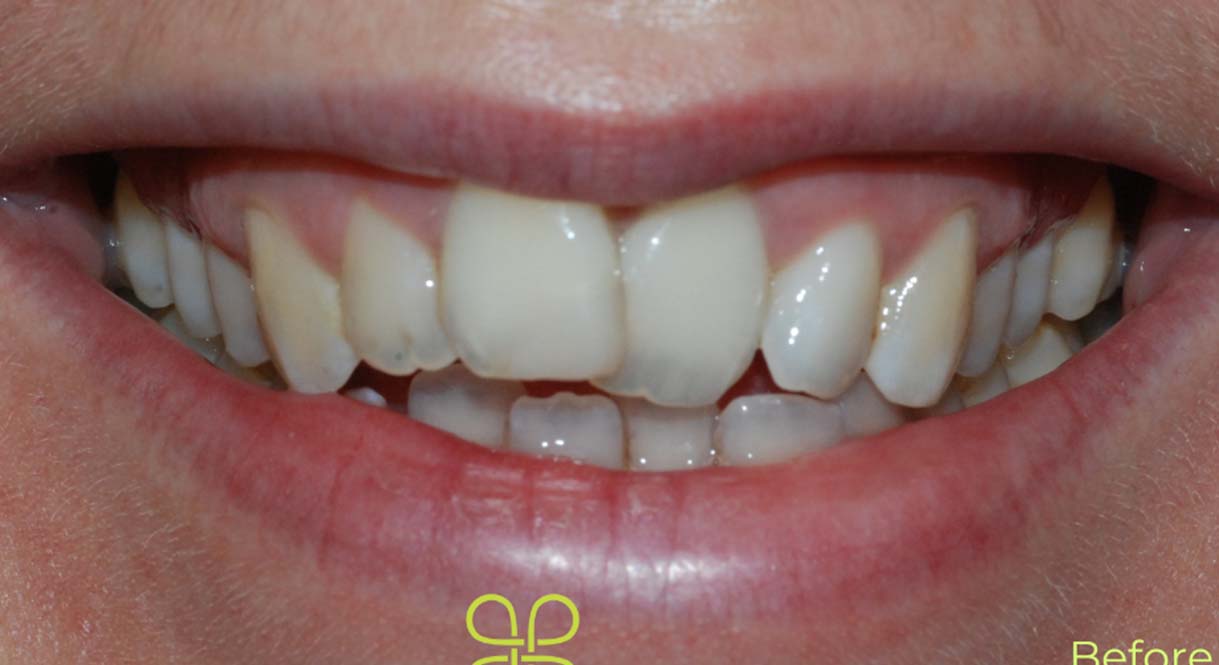 Before - Hello Dental