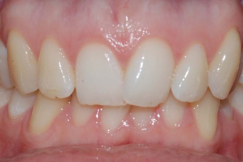 Before - Hello Dental